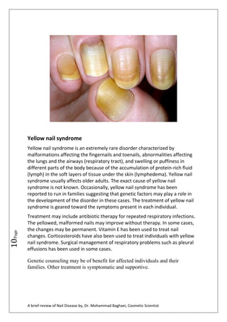 a brief review of nail diseases by dr mohammad baghaei 11 320