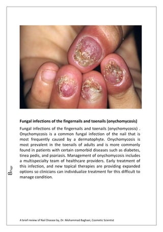 PDF) Early Stage Disease Diagnosis System Using Human Nail Image Processing