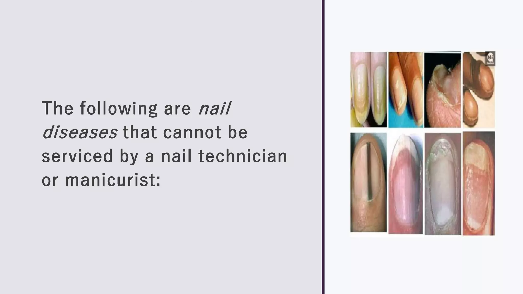 Dis Nails Nail Diseases and Disorders.pptx