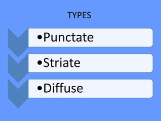 TYPES
•Punctate
•Striate
•Diffuse
 