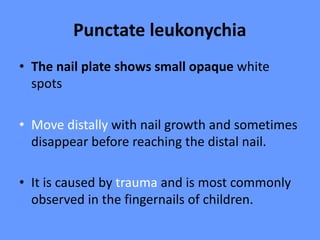 Punctate leukonychia
• The nail plate shows small opaque white
spots
• Move distally with nail growth and sometimes
disappear before reaching the distal nail.
• It is caused by trauma and is most commonly
observed in the fingernails of children.
 