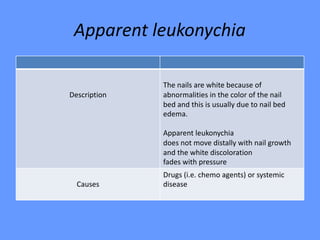 Apparent leukonychia
The nails are white because of
abnormalities in the color of the nail
bed and this is usually due to nail bed
edema.
Apparent leukonychia
does not move distally with nail growth
and the white discoloration
fades with pressure
Description
Drugs (i.e. chemo agents) or systemic
diseaseCauses
 