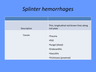 Splinter hemorrhages
Thin, longitudinal red-brown lines along
nail plateDescription
•Trauma
•PSO
•fungal (distal)
•Endocarditis
•Vasculitis
•Trichinosis (proximal)
Causes
 