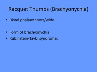 Racquet Thumbs (Brachyonychia)
• Distal phalanx short/wide
• Form of brachyonychia
• Rubinstein-Taybi syndrome,
 