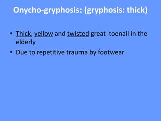 Onycho-gryphosis: (gryphosis: thick)
• Thick, yellow and twisted great toenail in the
elderly
• Due to repetitive trauma by footwear
 