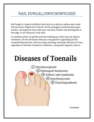 NAIL FUNGAL/ONYCHOMYCOSIS
Nail fungal is a typical condition that starts as a white or yellow spot under
the tip of your fingernail or toenail. As the contagious contamination goes
further, nail organism may make your nail stain, thicken and disintegrate at
the edge. It can influence a few nails.
In condition when it is gentle and not irritating you, then may not require
treatment. On the off chance that your nail growth is agonizing and has
caused thickened nails, self-care steps and drugs may help. Be that as it may,
regardless of whether treatment is effective, nail growth regularly returns.
 