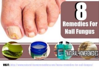 VISIT : http://www.natural-homeremedies.com/home-remedies-for-nail-fungus/
 