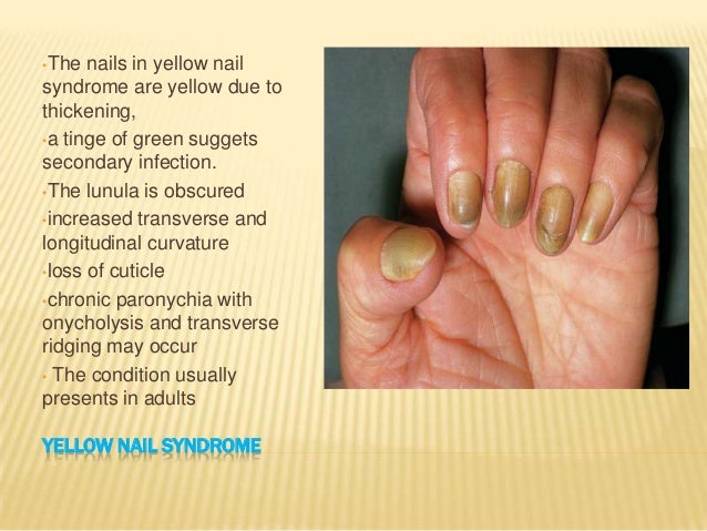 Nail Seminar