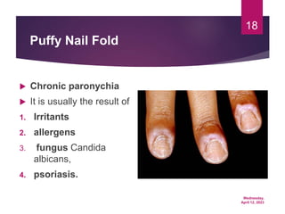 Wednesday,
April 12, 2023
18
Puffy Nail Fold
 Chronic paronychia
 It is usually the result of
1. Irritants
2. allergens
3. fungus Candida
albicans,
4. psoriasis.
 