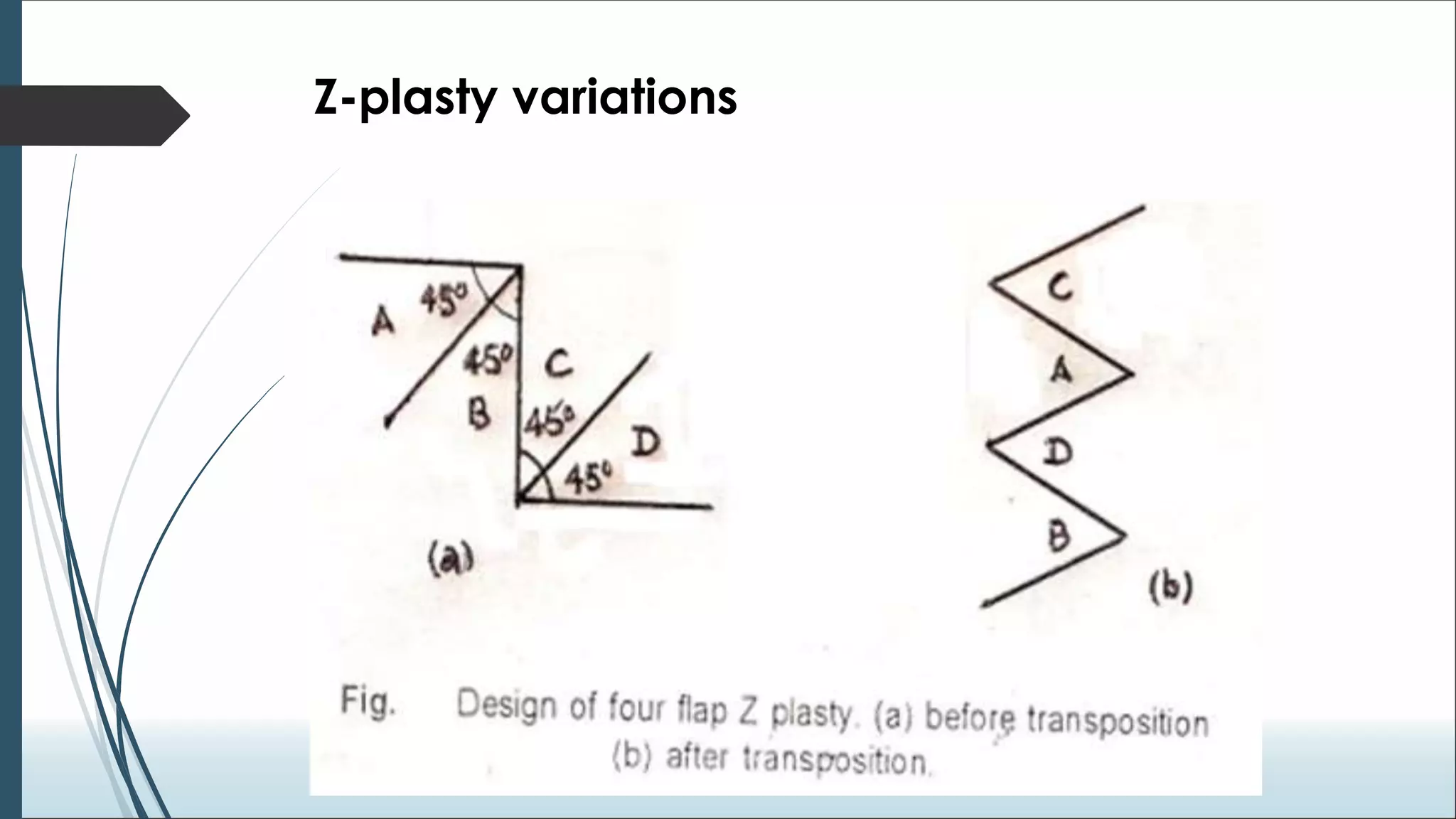 Biogeometry of flaps.ppt