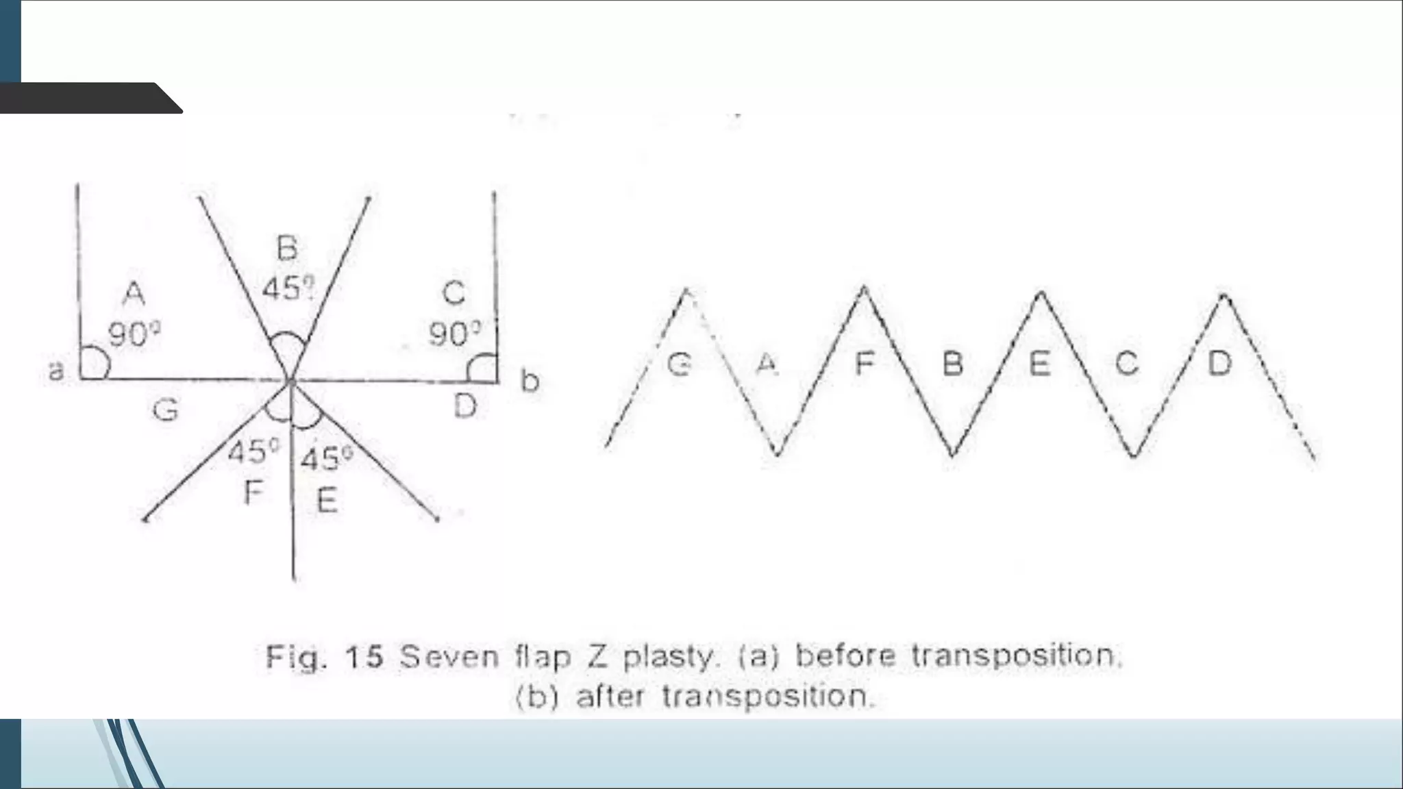 Biogeometry of flaps.ppt