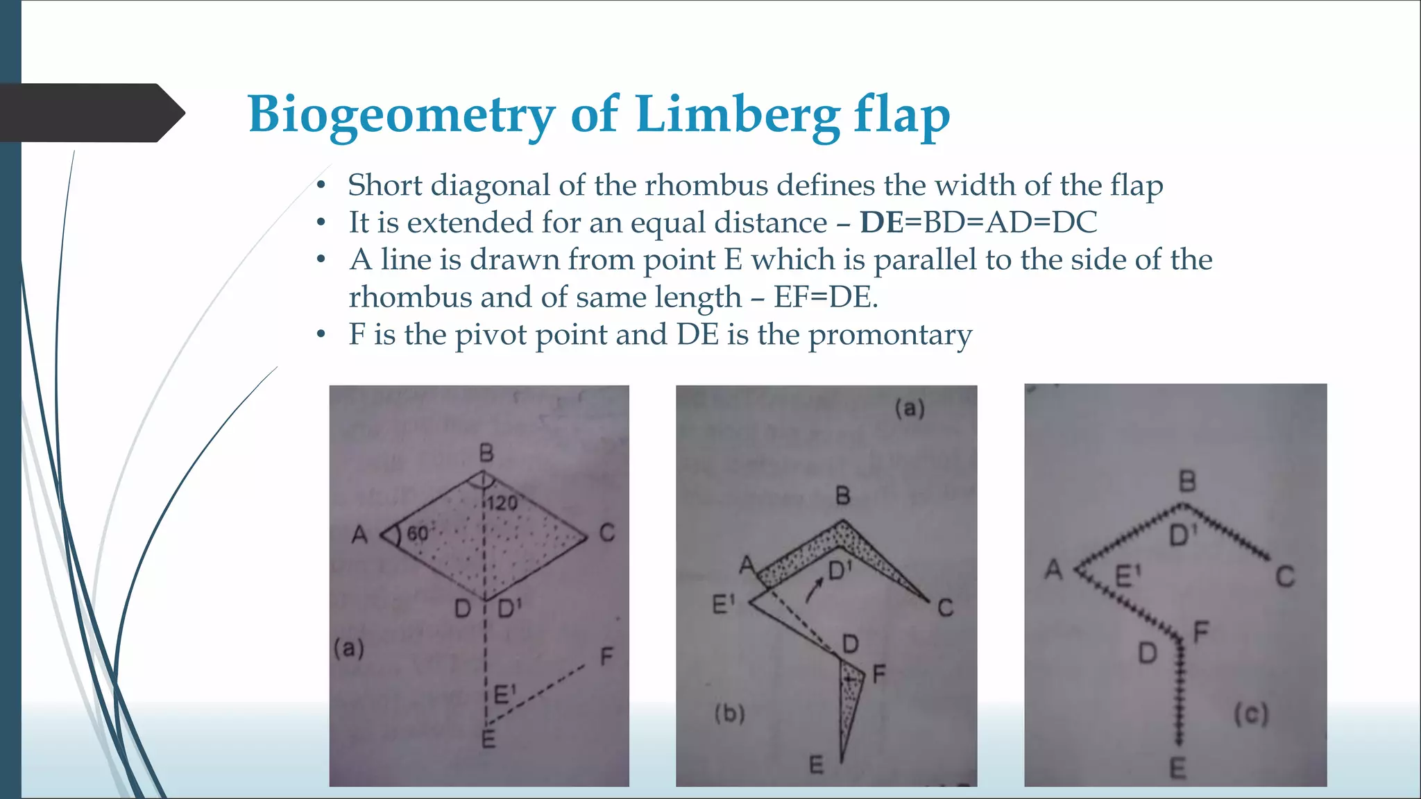 Biogeometry of flaps.ppt