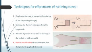 Biogeometry of flaps.ppt