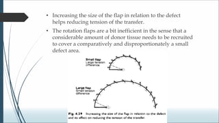 Biogeometry of flaps.ppt