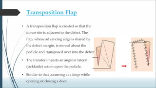 Transposition Vs Rotation Flap Biogeometry of flaps.ppt