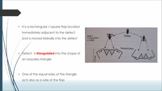 Biogeometry of flaps.ppt