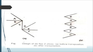 Biogeometry of flaps.ppt