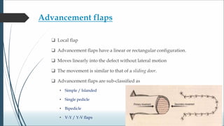 Biogeometry of flaps.ppt