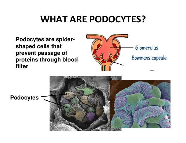 Fabry Disease Urinary Podocyte Loss 14 February 2014
