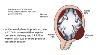 PLACENTA ACCRETA SPECTRUM
Revise guideline adopted from FIGO
guidelines for PAS
• Incidence of placenta previa accrete
is 4.1 % in women with one prior
caesarean delivery and 13.3 % in
women with two or more previous
caesarean section.
 