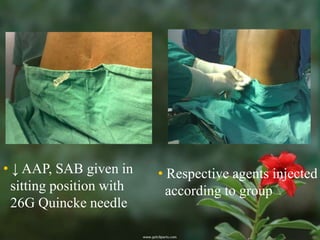 • ↓ AAP, SAB given in     • Respective agents injected
  sitting position with     according to group
  26G Quincke needle
 