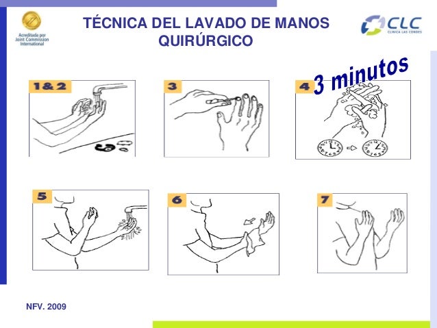 Naldy febré lav manos perú1