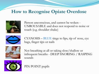 How to Recognise Opiate Overdose 
Person unconscious, and cannot be woken - 
UNROUSABLE and does not respond to noise or 
touch (e.g. shoulder shake) 
CYANOSIS – BLUE tinge to lips, tip of nose, eye 
bags, finger tips or nails 
Not breathing at all or taking slow/shallow or 
infrequent breaths - DEEP SNORING / RASPING 
sounds 
PIN POINT pupils 
 