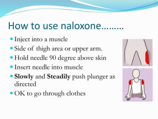 How to use naloxone……… 
 Inject into a muscle 
 Side of thigh area or upper arm. 
 Hold needle 90 degree above skin 
 Insert needle into muscle 
 Slowly and Steadily push plunger as 
directed 
OK to go through clothes 
 