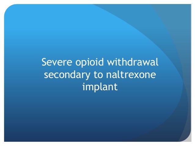 Naltrexone Implant