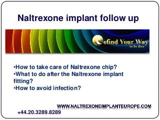 Naltrexone implant follow up
•How to take care of Naltrexone chip?
•What to do after the Naltrexone implant
fitting?
•How to avoid infection?
+44.20.3289.8289
 