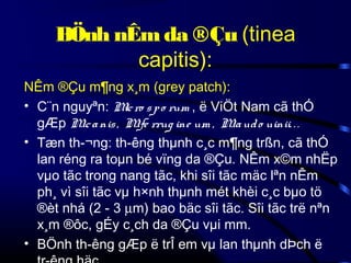BÖnh nÊm da ®Çu (tinea
capitis):
NÊm ®Çu m¶ng x¸m (grey patch):
• C¨n nguyªn: M ro s p o rum , ë ViÖt Nam cã thÓ
ic
gÆp Mc a nis , Mfe rrug ine um , Ma ud o uinii. . .
.
.
.
• Tæn th­¬ng: th­êng thµnh c¸c m¶ng trßn, cã thÓ
lan réng ra toµn bé vïng da ®Çu. NÊm x©m nhËp
vµo tãc trong nang tãc, khi sîi tãc mäc lªn nÊm
ph¸ vì sîi tãc vµ h×nh thµnh mét khèi c¸c bµo tö
®èt nhá (2 - 3 µm) bao bäc sîi tãc. Sîi tãc trë nªn
x¸m ®ôc, gÉy c¸ch da ®Çu vµi mm.
• BÖnh th­êng gÆp ë trÎ em vµ lan thµnh dÞch ë

 