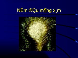 NÊm ®Çu m¶ng x¸m

 