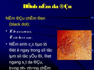 BÖnh nÊm da ®Çu
NÊm ®Çu chÊm ®en
(black dot):
• T. to ns ura ns ,
T. vio la c e um .
• NÊm sinh c¸c bµo tö
®èt ë ngay trong sîi tãc
lµm sîi tãc yÕu ®i, ®øt
ngang s¸t da ®Çu,
tr«ng nh­ nh÷ng chÊm

 