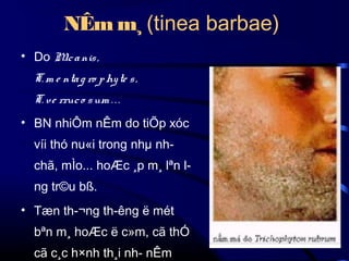 NÊm m¸ (tinea barbae)
• Do Mc a nis ,
.
T. m e nta g ro p hy te s ,
T. ve rruc o s um . . .
• BN nhiÔm nÊm do tiÕp xóc
víi thó nu«i trong nhµ nh­
chã, mÌo... hoÆc ¸p m¸ lªn l­
ng tr©u bß.
• Tæn th­¬ng th­êng ë mét
bªn m¸ hoÆc ë c»m, cã thÓ
cã c¸c h×nh th¸i nh­ nÊm

 