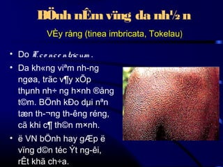 BÖnh nÊm vïng da nh½ n
VÈy rång (tinea imbricata, Tokelau)
• Do T. c o nc e ntric um .
• Da kh«ng viªm nh­ng
ngøa, trãc v¶y xÕp
thµnh nh÷ ng h×nh ®ång
t©m. BÖnh kÐo dµi nªn
tæn th­¬ng th­êng réng,
cã khi c¶ th©n m×nh.
• ë VN bÖnh hay gÆp ë
vïng d©n téc Ýt ng­êi,
rÊt khã ch÷a.

 