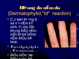 DÞ øng do nÊm da
(Dermatophytid,"Id" reaction)
• C¸c tæn th­¬ng ë
xa n¬i nÊm kÝ
sinh, t¹i chç XN
kh«ng thÊy nÊm,
mÊt ®i khi bÖnh
nÊm ®iÒu trÞ
khái.
• T. m e nta g ro p hy te s
, T. ve rruc o s um . . .
• BiÓu hiÖn: tæ

 
