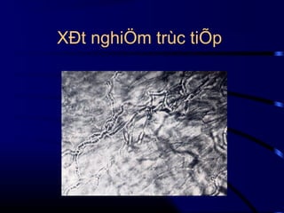 XÐt nghiÖm trùc tiÕp

 