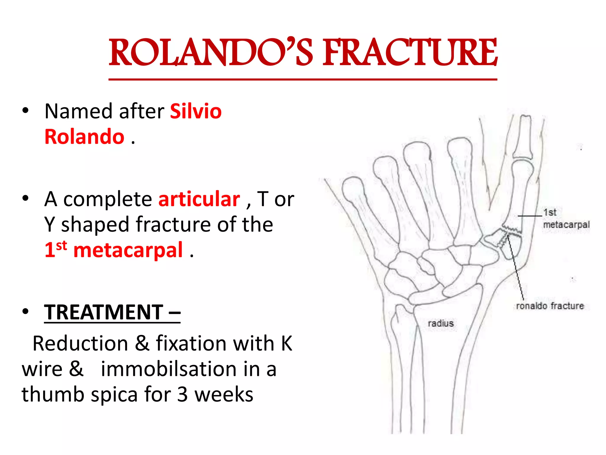 Named fractures of forearm ,wrist &and hand | PPTX