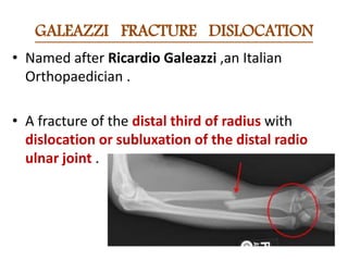 Named fractures of forearm ,wrist &and hand | PPTX