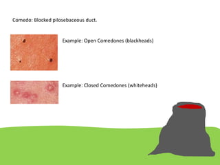 naming-skin-lesion for cvt and for cdu Hyderabad Telangana for india | PPT