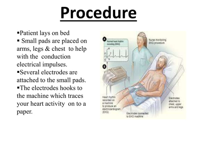 Cardiac Function Test
