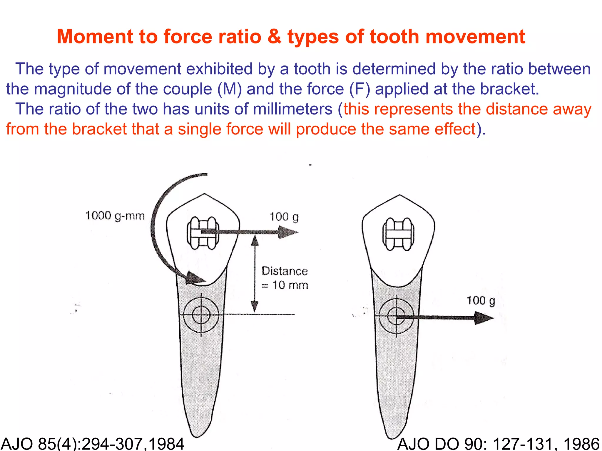 Orthodontic biomechanics / orthodontic courses in india / /certified
