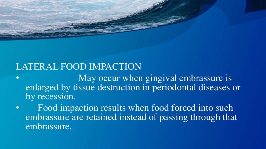 FOOD IMPACTION AND TREATMENT