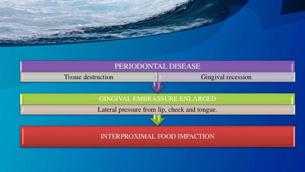FOOD IMPACTION AND TREATMENT