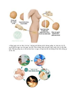 + Nâng ngực nội soi: Bác sĩ sẽ tạo 1 đường mổ (đường nách, đường quầng vú, hoặc dạ vú) rồi
sau đó đặt túi ngực sao cho ngực cân đối 2 bên, không chèn ép mạch máu, tuyến sữa và dây thần
kinh. Phương pháp này có độ an toàn hơn, và ngực sẽ đẹp trọn đời mà không để lại biến chứng gì
về lâu dài.
 