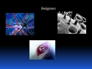 Imágenes
 