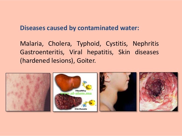 download Variational