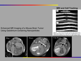 MRI and Cell Tracking

Enhanced MR Imaging of a Mouse Brain Tumor
Using Gadolinium-containing Nanoparticles

Pre-

cont
rast

Postcontrast

5 hr Postcontrast

 