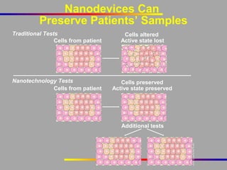 Nanodevices Can
Preserve Patients’ Samples
Traditional Tests
Cells from patient

Cells altered
Active state lost

Nanotechnology Tests
Cells from patient

Cells preserved
Active state preserved

Additional tests

 