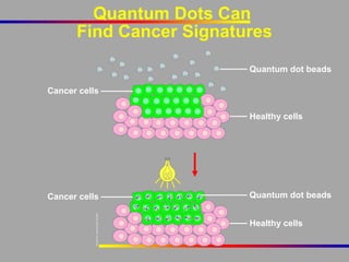 Quantum Dots Can
Find Cancer Signatures
Quantum dot beads
Cancer cells
Healthy cells

Cancer cells

Quantum dot beads
Healthy cells

 